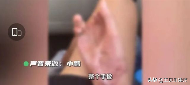 19岁被强制实习，手卷入机器一小时才取出：致残！学校称自己协商