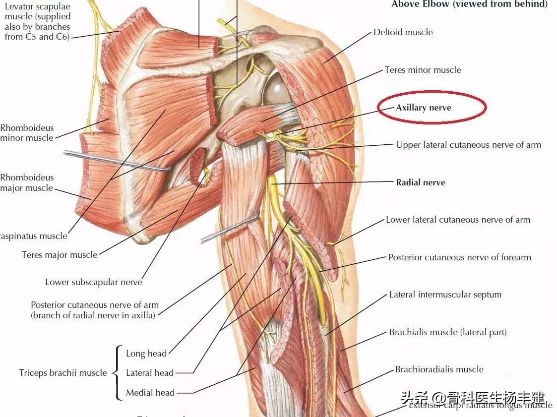 骨折手术愈合后，钢板拆还是不拆？你要的问题答案在这里