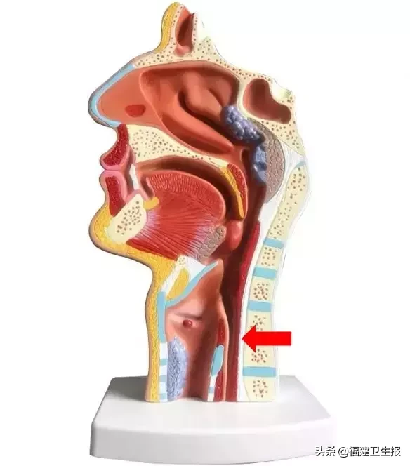 神奇!福州7旬老伯吞咽困难9个多月,一针“除皱针”解决大问题