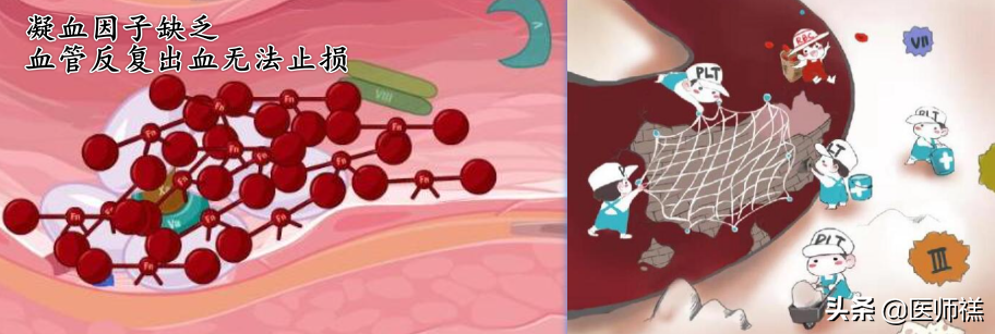 无缘无故流鼻血？以下一些健康问题，医生希望你一定要明白