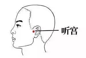 耳鸣不要命但烦死人，学会这些方法可预防