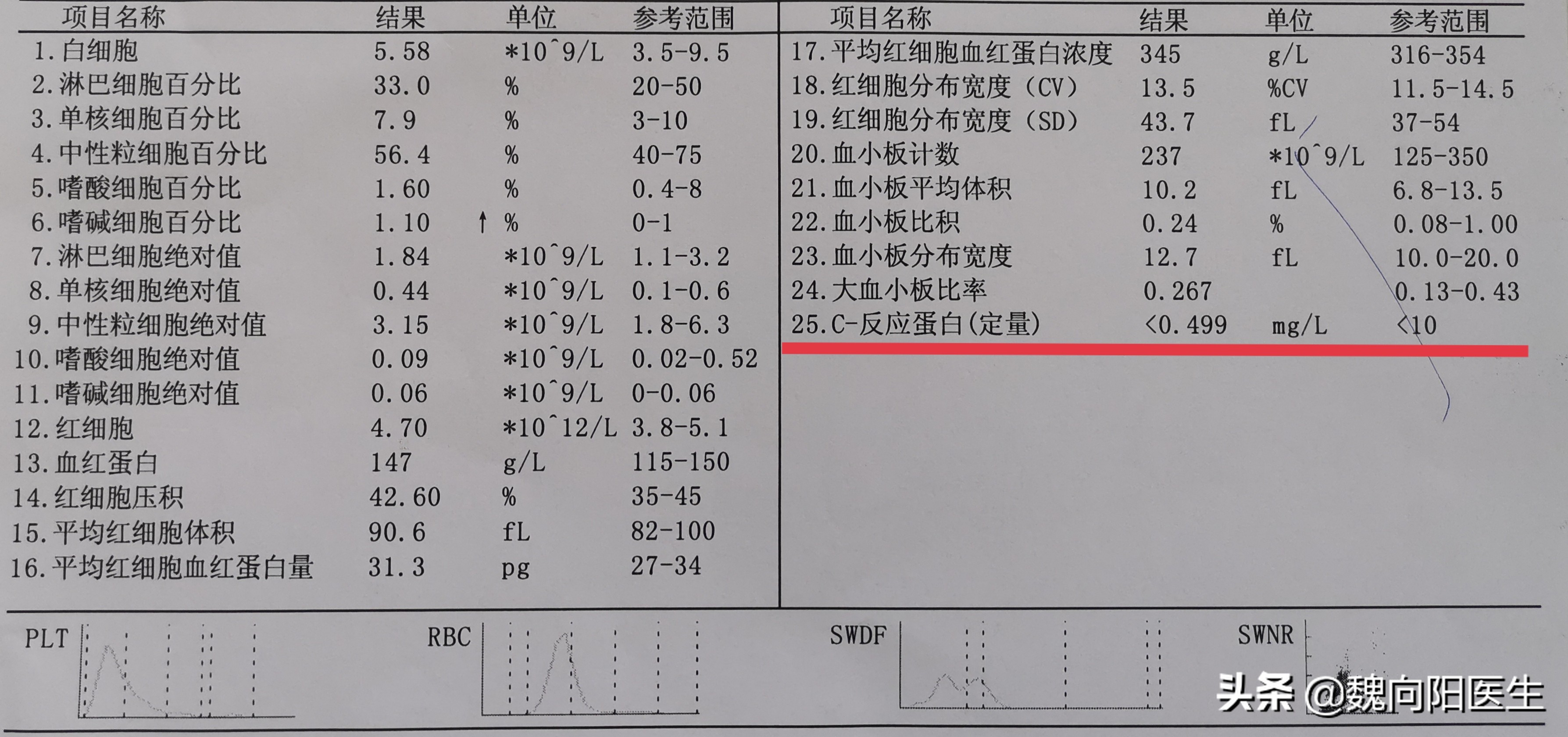 炎症指标——C反应蛋白（手把手教你读化验报告之5）