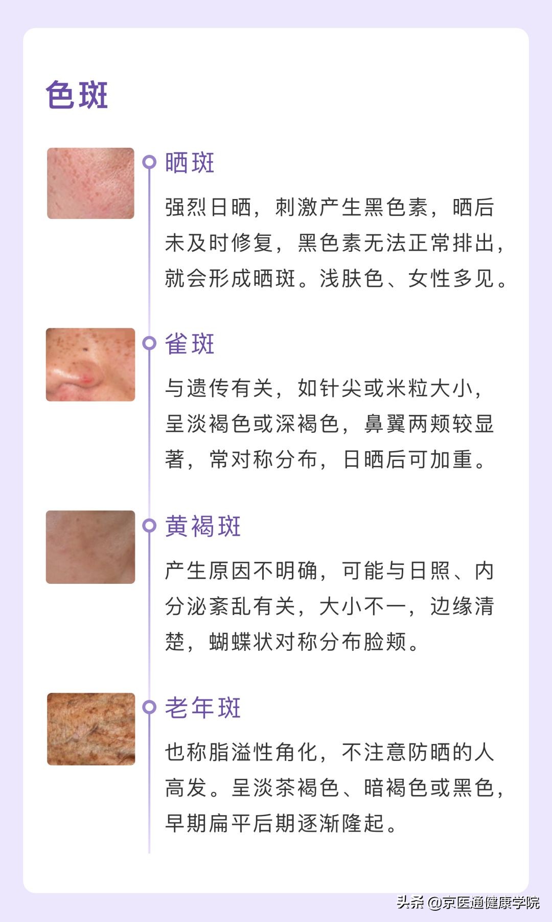 皮秒拿走的是「斑点」，还是你的不自信？