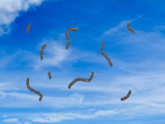 眼前有漂浮 当心飞蚊症