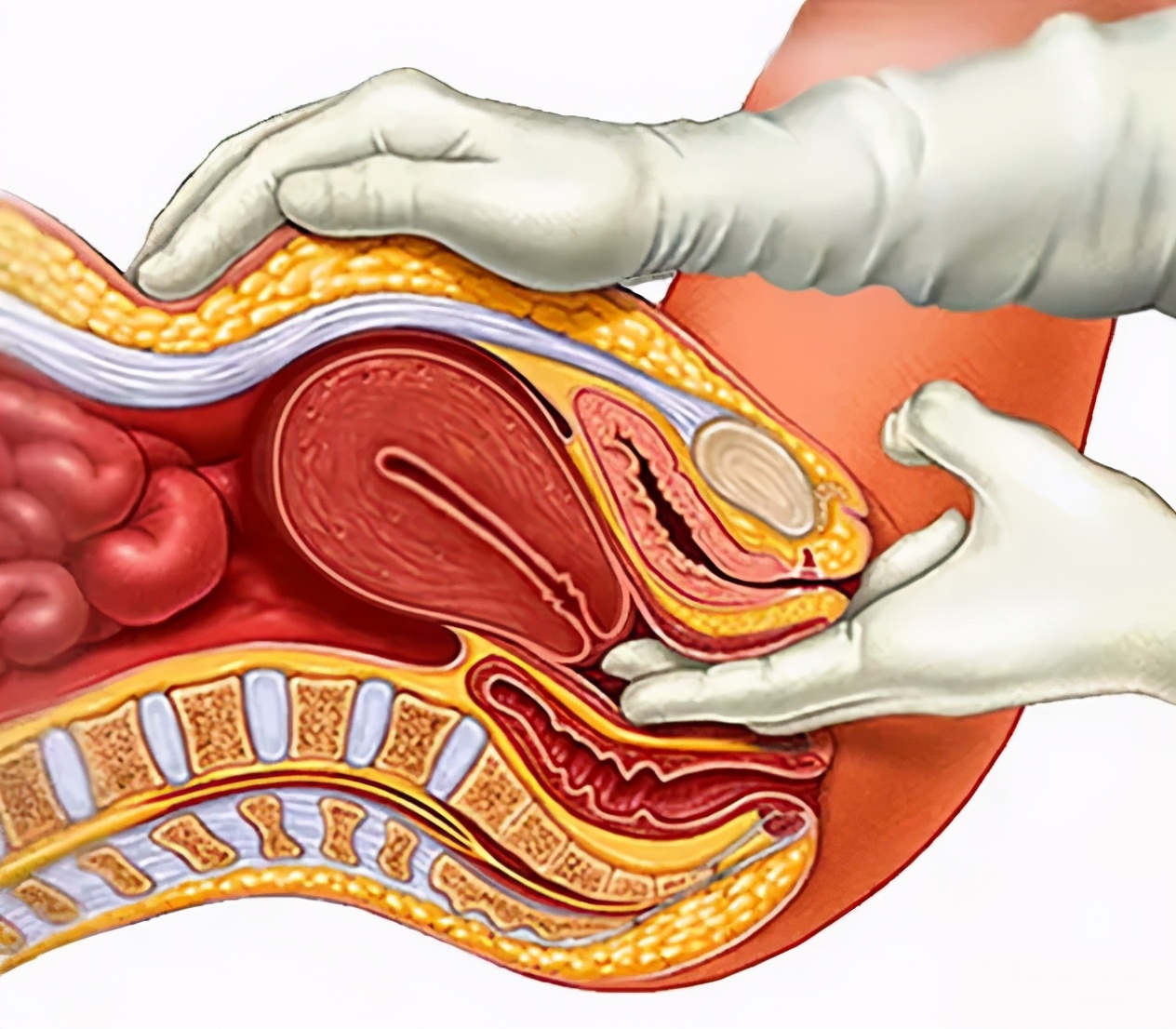 一根手指或者两根,探入阴道内,置于宫颈或者后穹窿的位置,同时,另一只