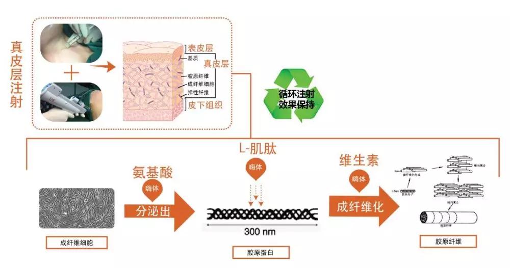 注射、线雕、拉皮、超声刀怎么选？| 北大教授张宗学