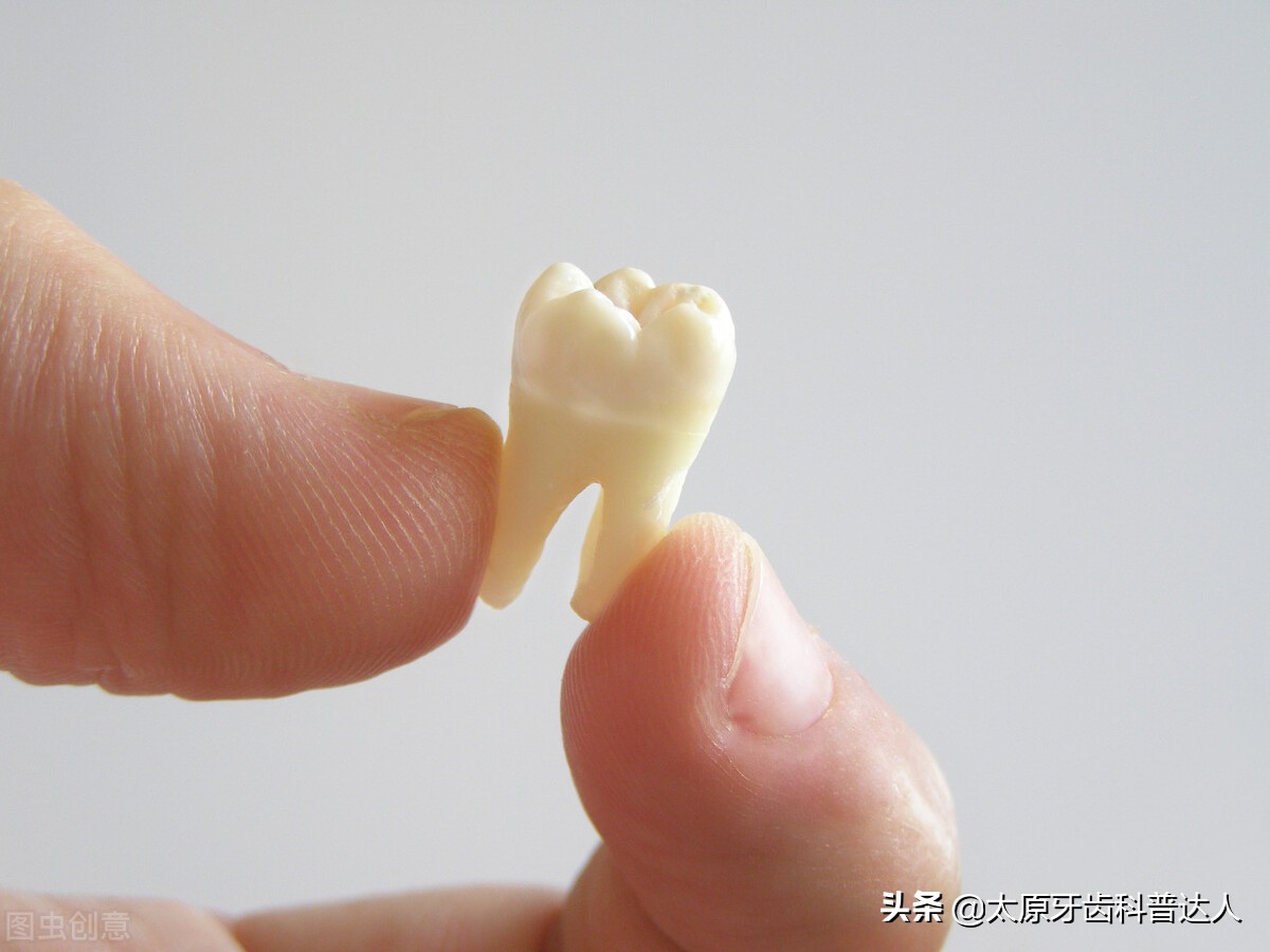 拔牙后要怎样护理伤口？