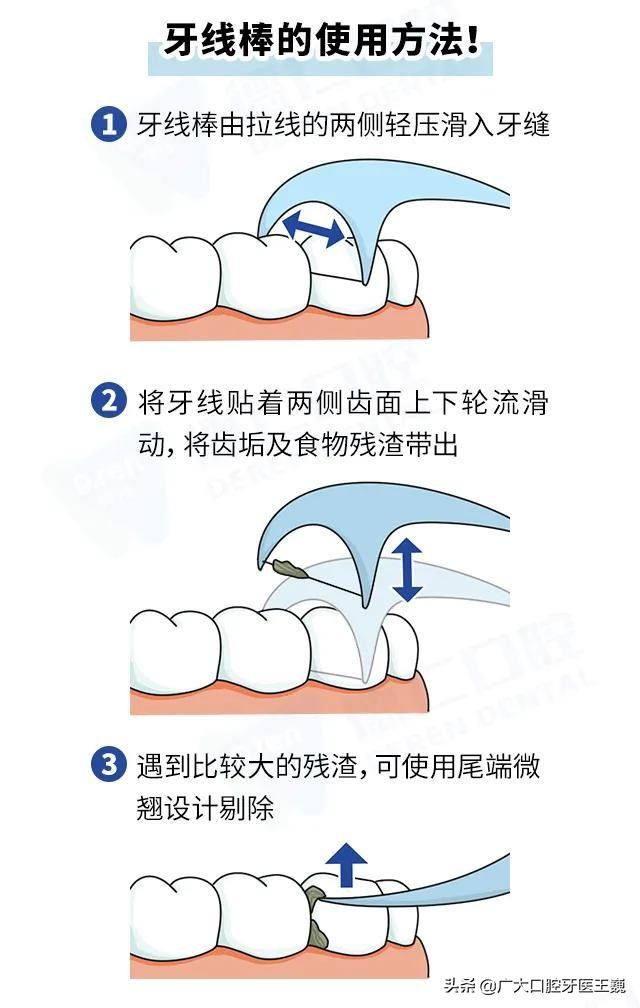 想要保住松动牙齿这4招很管用！学会后可以把牙齿保留更久