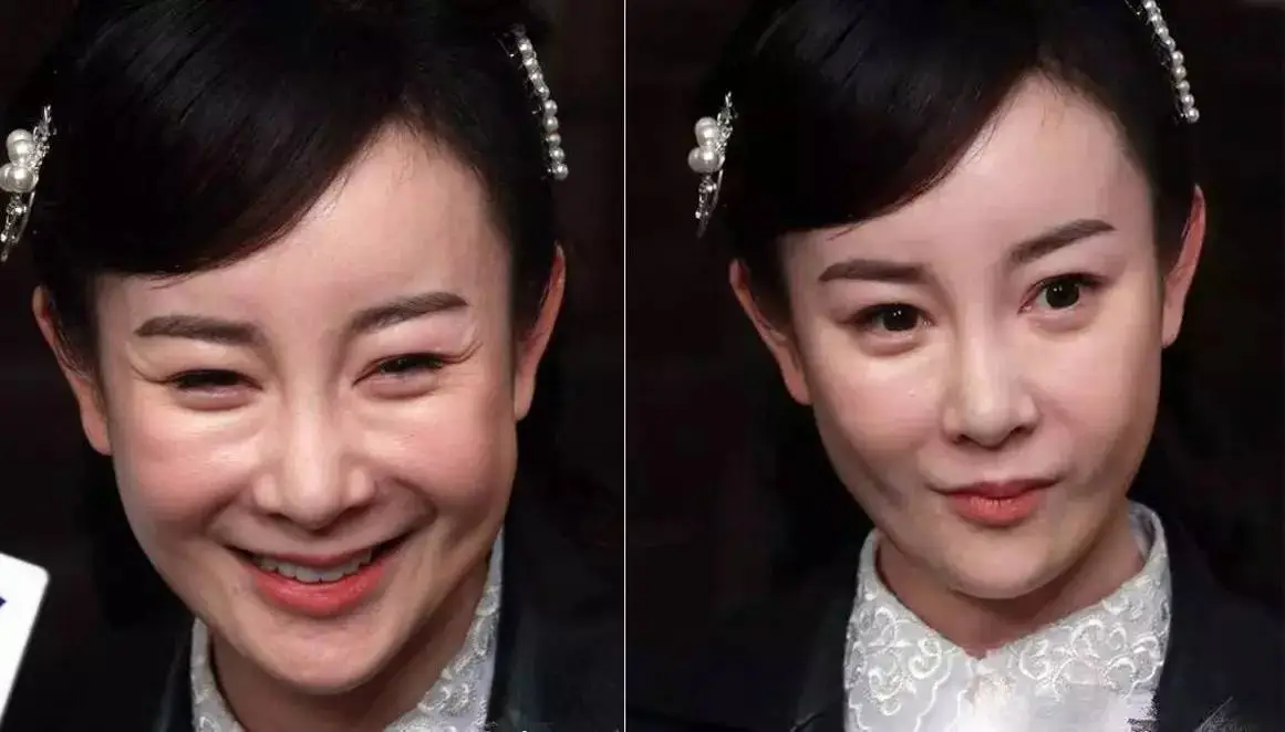 娱乐圈10位被整容毁掉的女星，有人脸僵如石，有的命丧手术台
