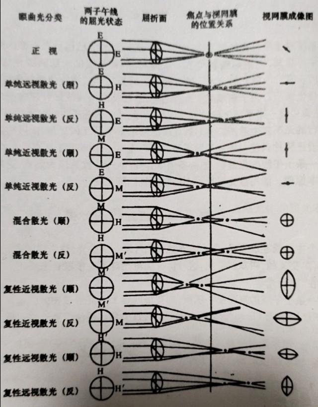 散光轴位多少正常(从未有人把) - 青木春