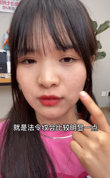 47岁七阿姨承认打瘦脸针！称打瘦脸针会落下后遗症：法令纹加重