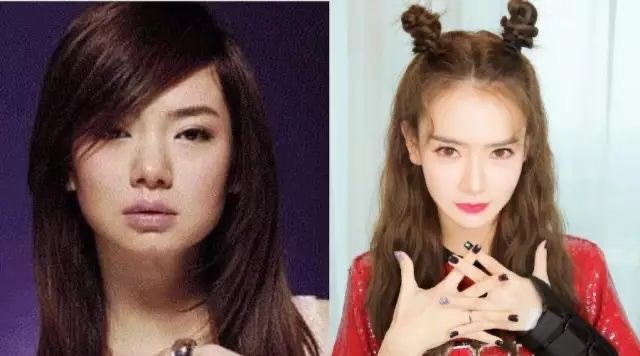 都说整容是娱乐圈“大忌”，而这10位明星，却因整容走向人生巅峰