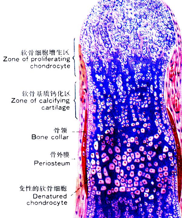 硫酸与盐酸氨基葡萄糖，哪种更适合膝关节退变的中老年人服用？