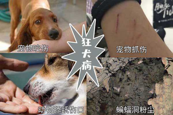 患有狂犬病的病人图片图片