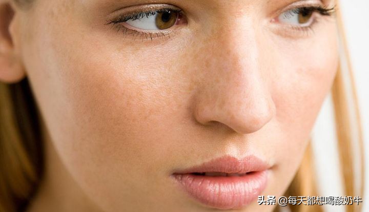 皮肤衰老的外在表现有哪些？