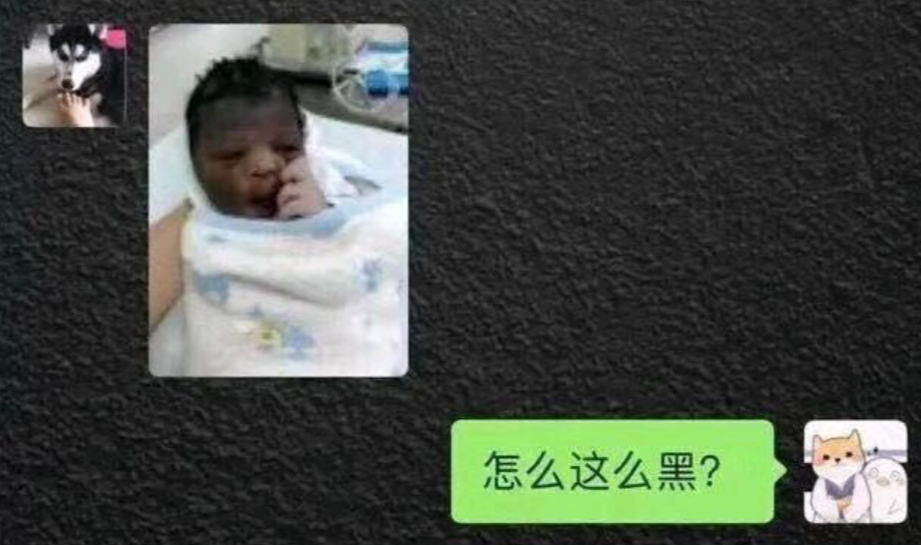 新生儿皮肤黑，被宝妈调侃“黑芝麻”吃多了，网友：是吃变异了？