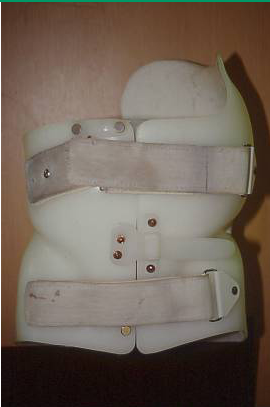 脊柱侧弯支具价格路医生说丨青少年脊柱侧弯保守治疗