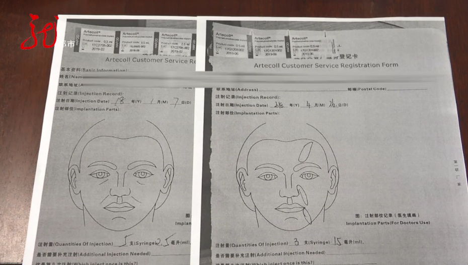 哈尔滨女子花5万做面部填充术，结果还得分三次取出！卫生监督所已展开调查