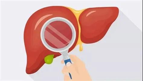 乙肝严不严重，不是看表面抗原和病毒DNA：你需要了解这些检查