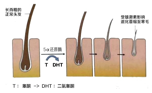 胡子长得快，雄性激素旺盛？别高兴太早，医生告诉您事情的真相