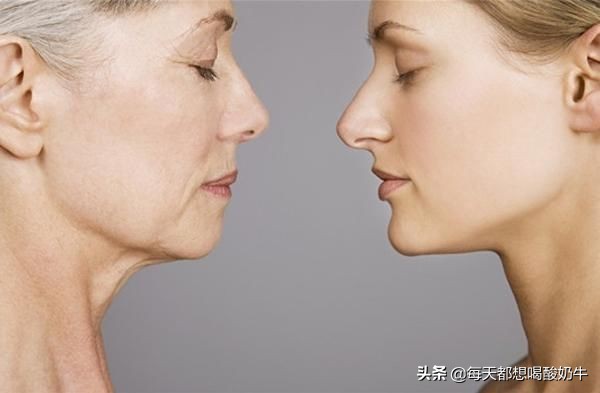 皮肤衰老的外在表现有哪些？