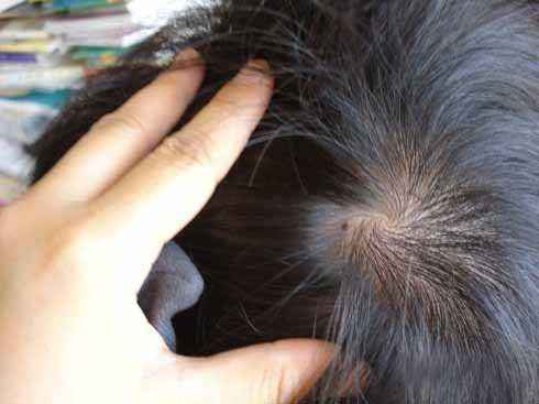 这5处有痣的男人是富贵命，事业有成疼妻爱子，你有这些痣吗？
