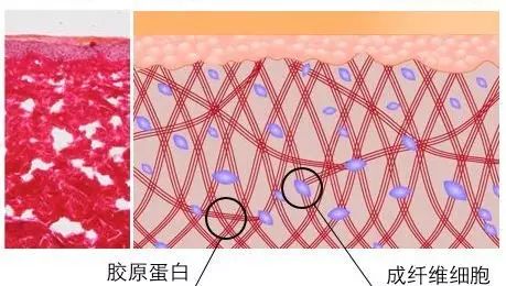 家用射频美容仪，Tripollar Stop效果如何？