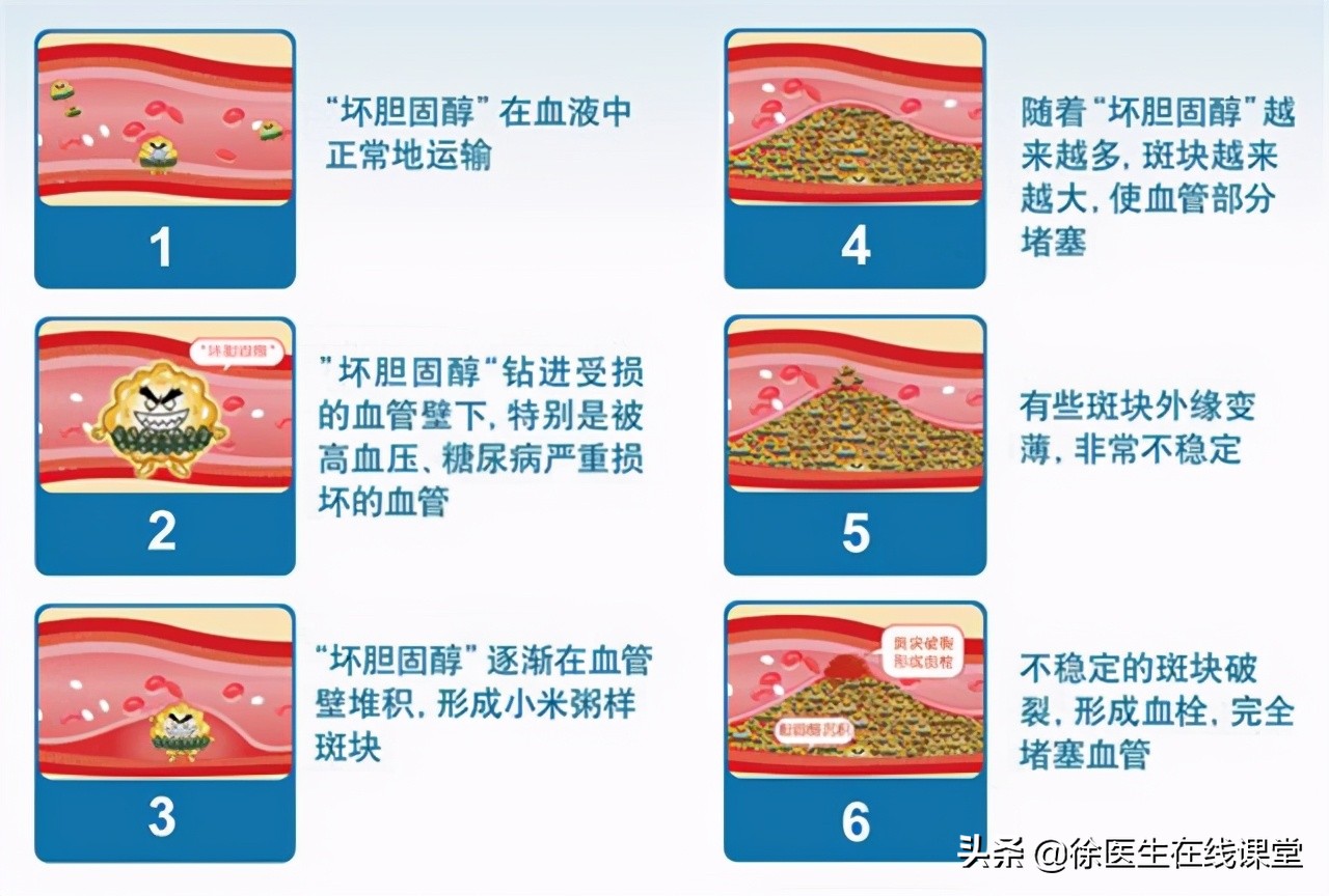 医生一步一步教您看血脂化验单，并不是有箭头就不正常