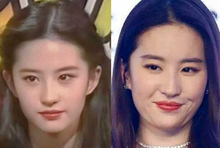 发腮？咬肌肥大？方脸女孩不削骨磨腮如何变美？如何拯救时髦感？