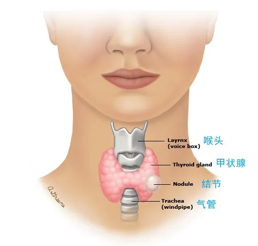 我们的甲状腺位于脖颈前方正中部位,形状酷似展翅的蝴蝶,紧贴在气管