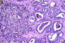 什么叫基因突变 什么叫杂合突变