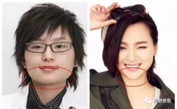 方脸短下巴，眼距宽怎么办？不动刀也能改善
