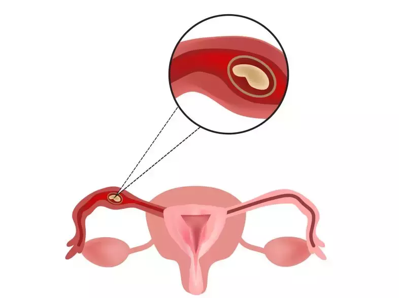 在高三儿子抽屉翻出避孕套，爸爸崩溃中发帖求助