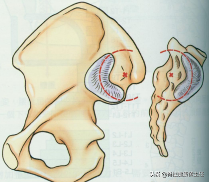 骶骨疼痛是什麼原因(別把這種腰痛錯當成腰椎間盤突出了) - 百百科
