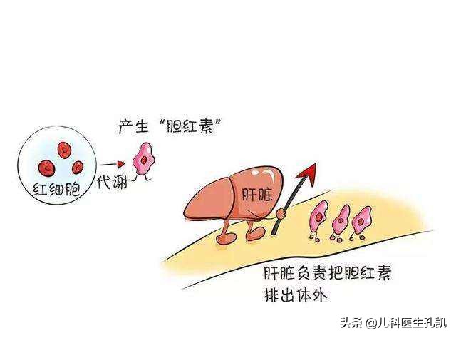 宝宝黄疸怎么办？生理性黄疸、病理性黄疸、母乳性黄疸如何区分？