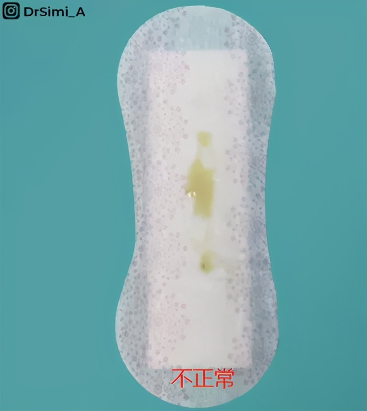 私处分泌物的6种变化，出现这3种颜色赶紧和他一起就医