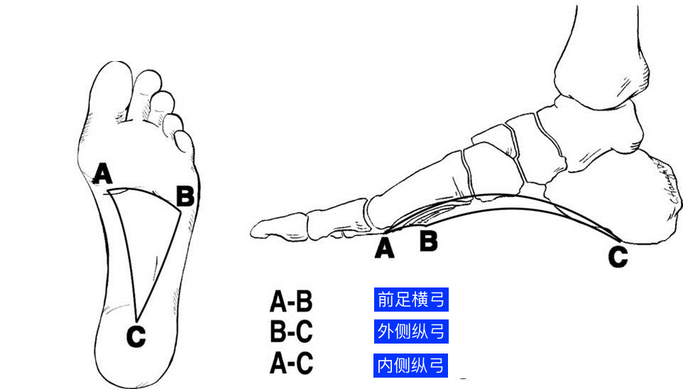 拐马脚示意图图片