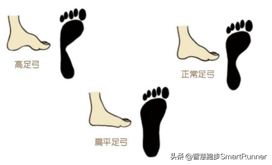 为什么每天坚持跑步，小腿却疼的要命？