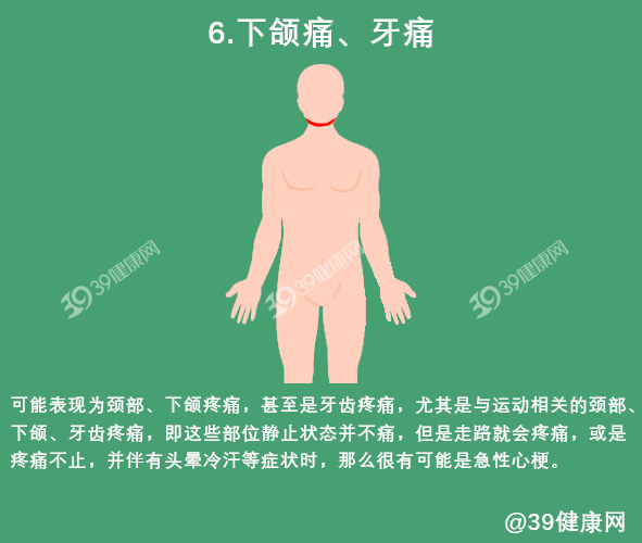 心肌缺血会出现哪些典型和不典型症状？怎么检查和吃药？一文说清