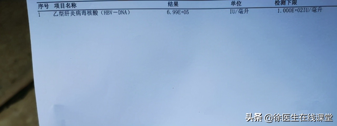 体检时发现两对半异常，又有乙肝，这时候该怎么办？请看此文