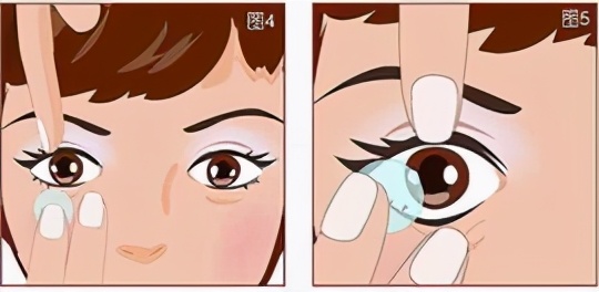 怎么戴隐形眼镜(隐形眼镜的佩戴方法)
