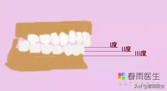 都在担心“地包天”,其实“天包地”也要警惕