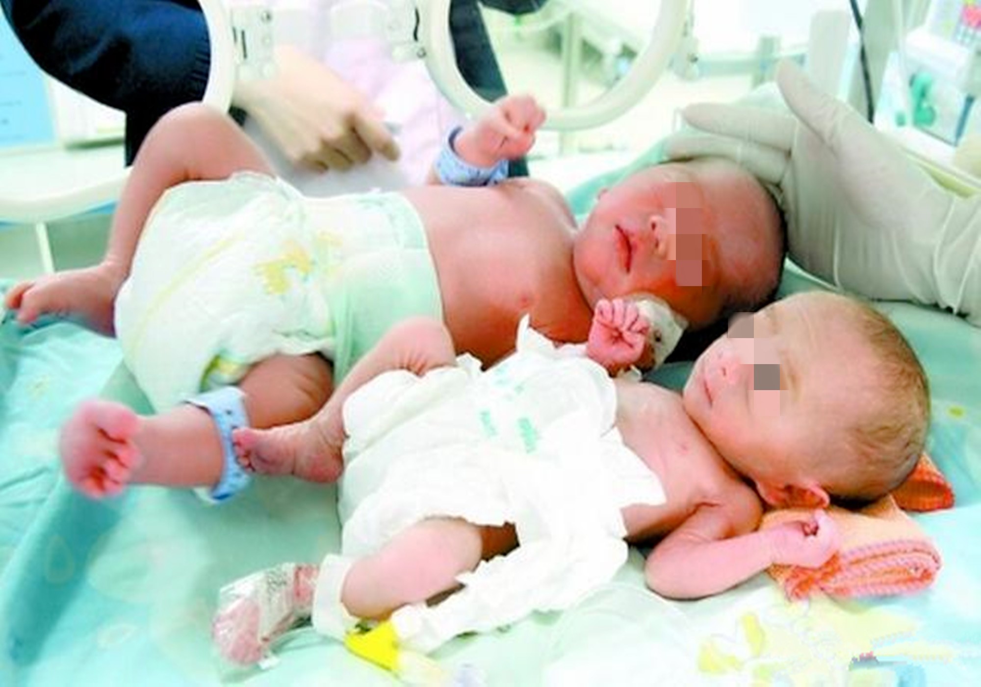 【1+1=4的幸福】悦程3天2对双胞胎宝宝顺利出生！-嘉兴悦程妇产医院-提供产检/分娩/月子/产后一站式医疗服务