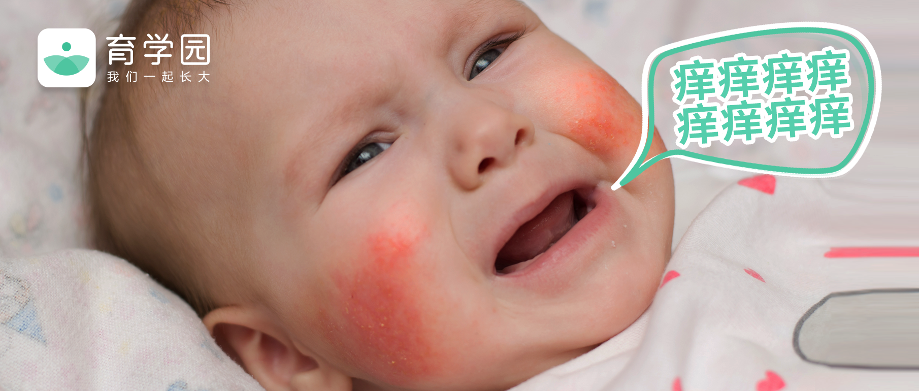 婴儿湿疹最佳治疗方法（土方法）