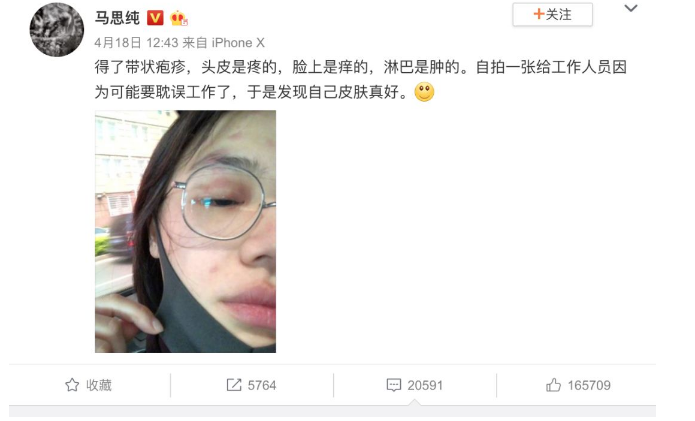 带状疱疹治疗方法及护理要点
