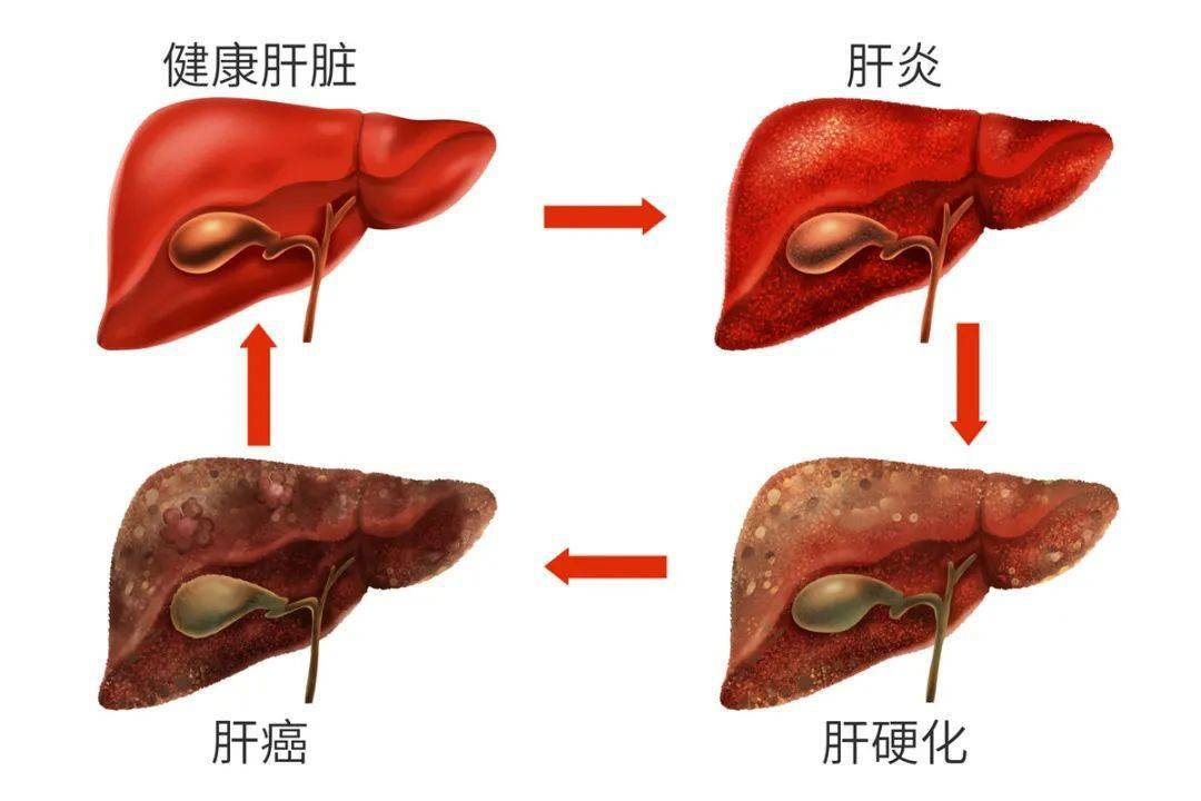 体内有病，手指先知？再次提醒：手指出现4种特征，小心疾病来袭