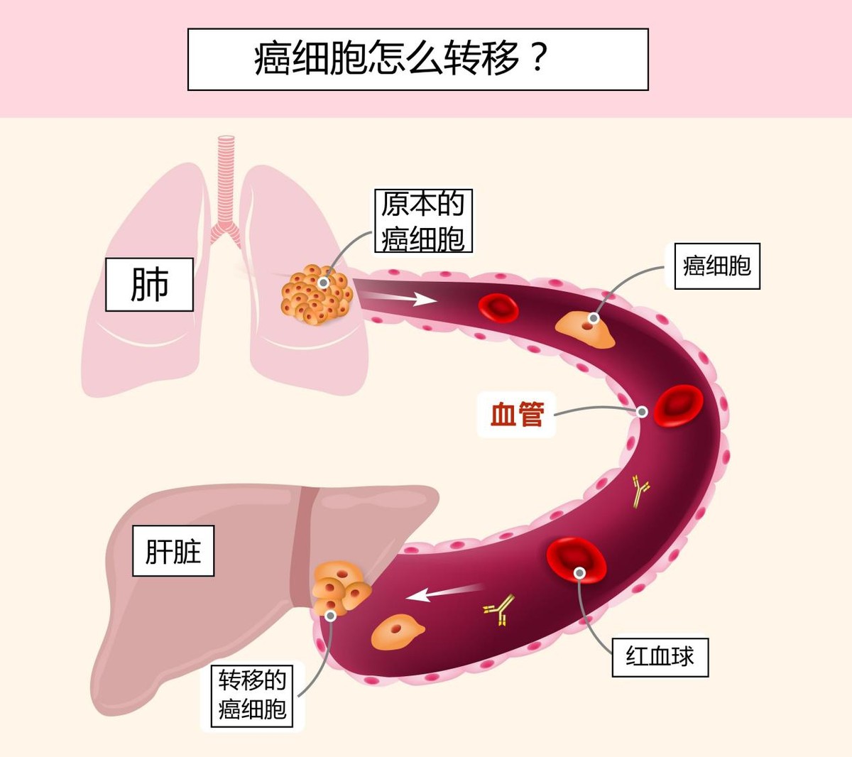 癌症患者有一半是被治死，一半是被吓死？不治疗反而能自愈？