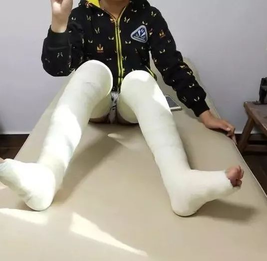 内八字怎么纠正 内八字走路矫正最佳方法 - 时代开运网