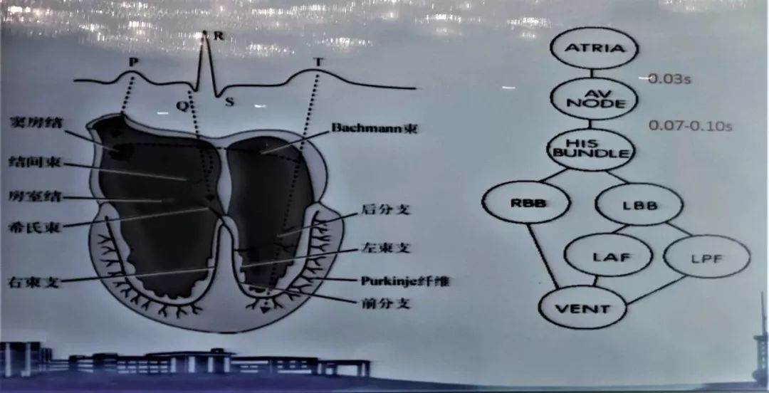 儿童心电图——你真的会读了吗？