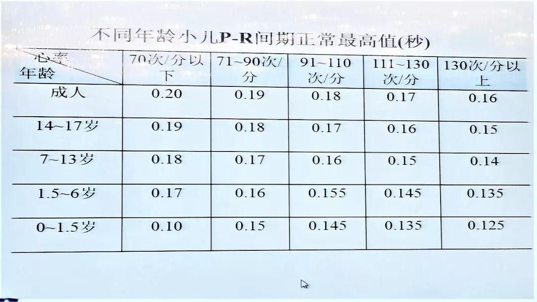 儿童心电图——你真的会读了吗？